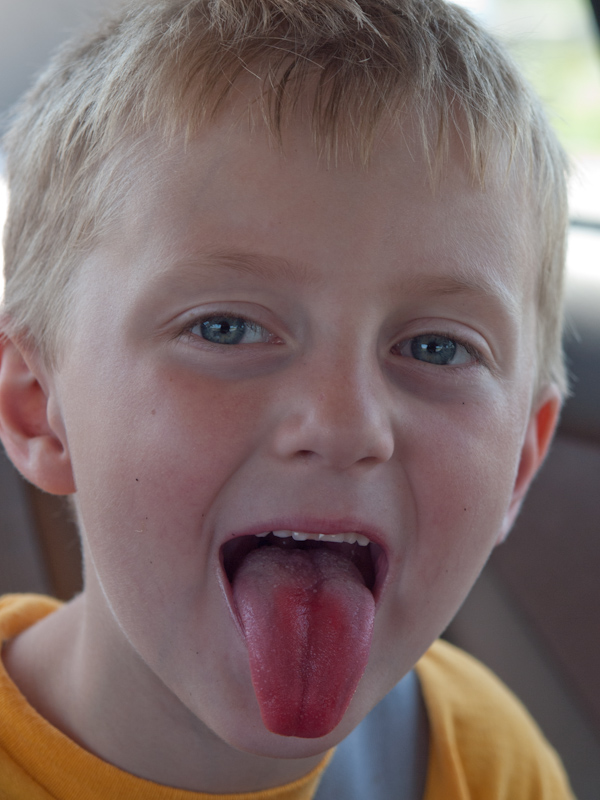 P7035424.jpg - Is my tongue red?